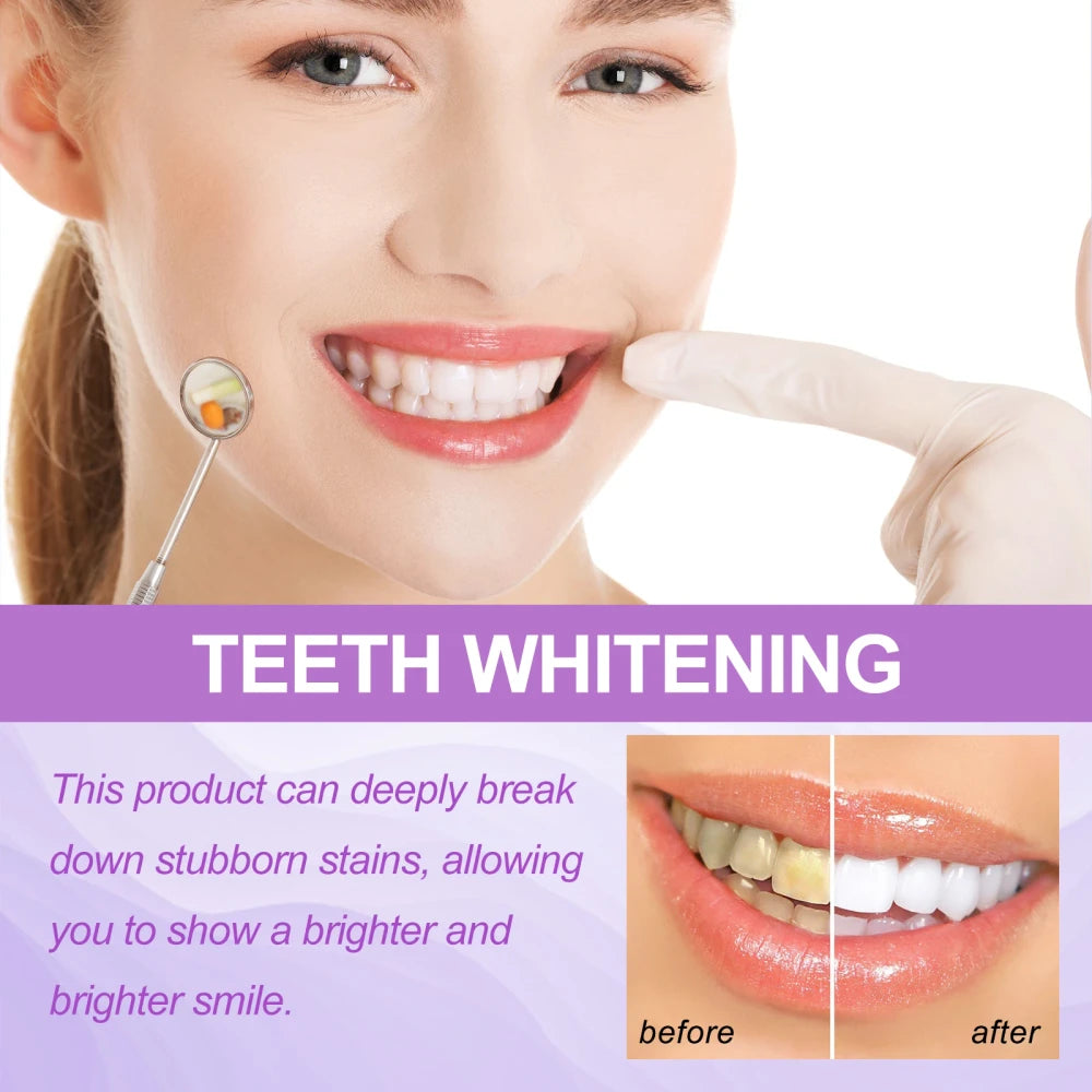 Jaysuing Purple Teeth Whitening Strips